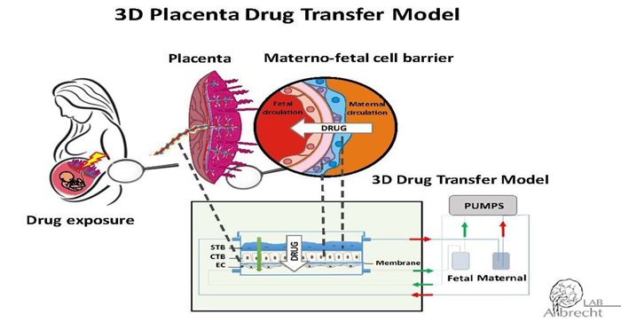 Schema